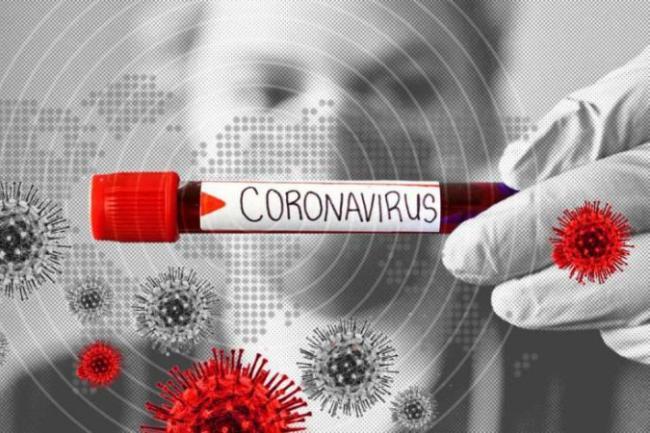 Azərbaycanda koronavirus peyvəndi ilk &ouml;ncə bu şəxslərə vurulacaq -  Xəbər şəkili